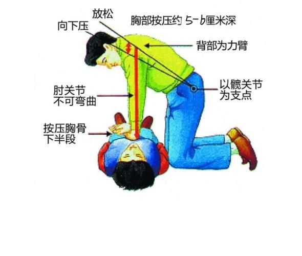 仰着摔怎么急救_仰着摔后多久能恢复