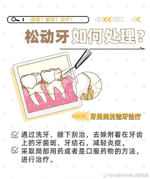 牙齿松动怎么办_牙齿松动能恢复吗