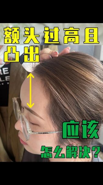 脑门突出怎么改善_脑门高适合什么发型
