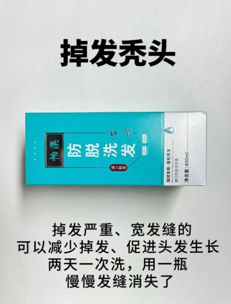 秃顶怎么治_秃顶用什么药