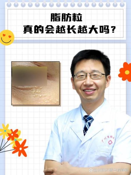 越长越大怎么办_越长越大正常吗