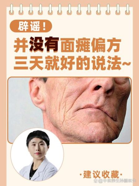 面部怀疑是面瘫吗_面部麻木多久算严重