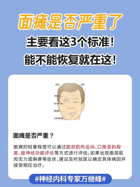 面部怀疑是面瘫吗_面部麻木多久算严重
