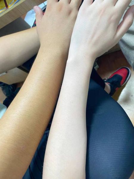 手机有紫外线吗_手机屏幕会晒黑皮肤吗