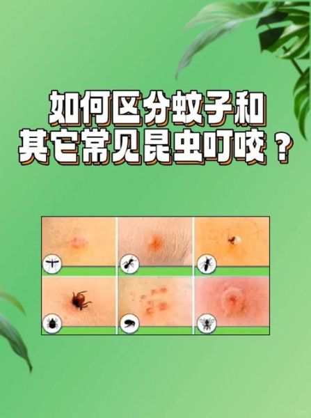 恐怖虫子咬人怎么办_家里常见恐怖虫子有哪些