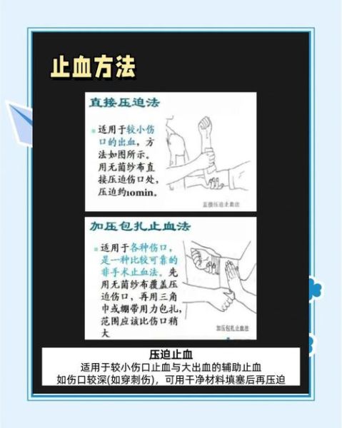 负伤流血怎么处理_伤口止血方法有哪些