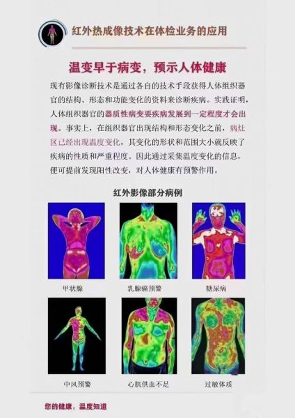 手机热成像能检测什么_手机热成像怎么使用