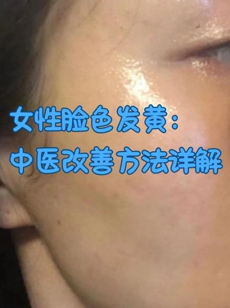 脸色发黄是什么原因_脸色发青怎么调理