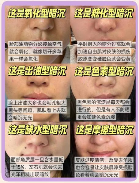 脸色发黄是什么原因_脸色发青怎么调理