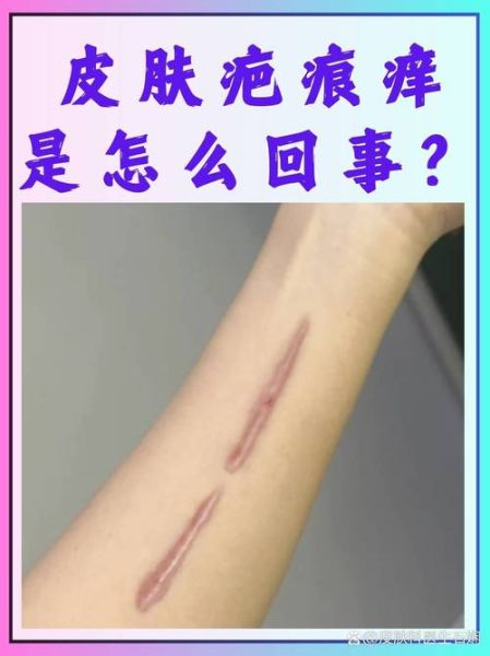 伤口为什么会疼_伤口为什么会痒