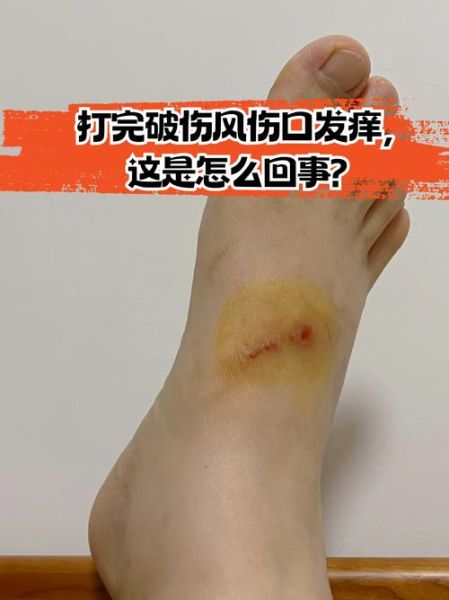 伤口为什么会疼_伤口为什么会痒