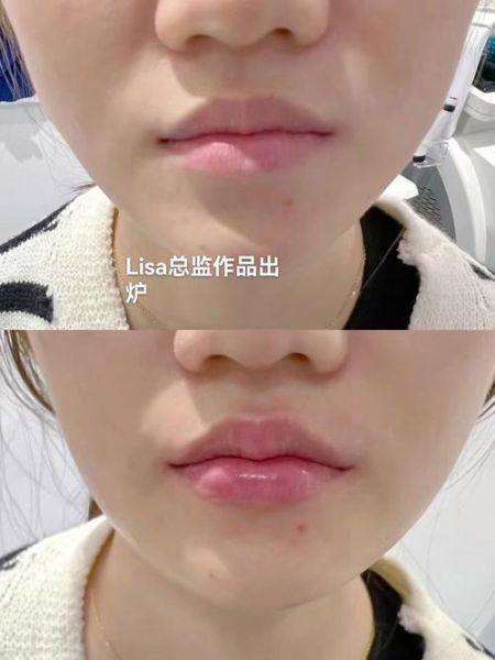 嘴较大怎么办_嘴大怎么化妆显小