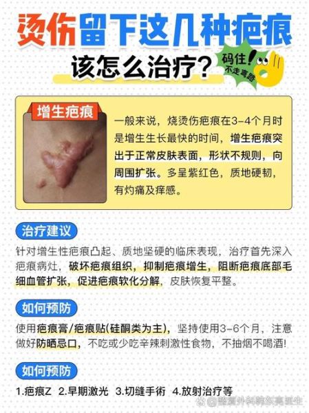 伤痕怎么消除_疤痕修复方法有哪些