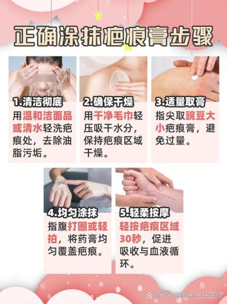 伤痕怎么消除_疤痕修复方法有哪些