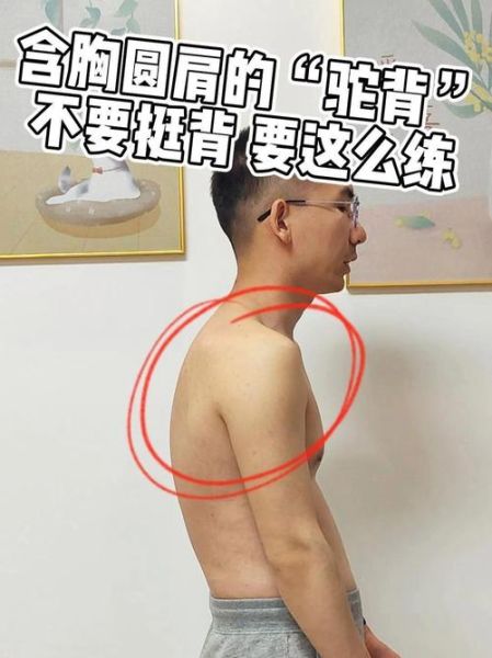 挺胸啥背是什么意思_如何纠正驼背姿势
