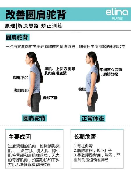 挺胸啥背是什么意思_如何纠正驼背姿势