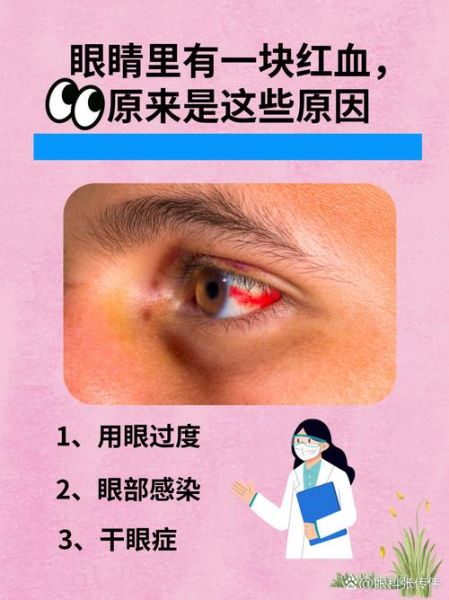 眼睛突然发亮是什么原因_眼睛发亮是病吗