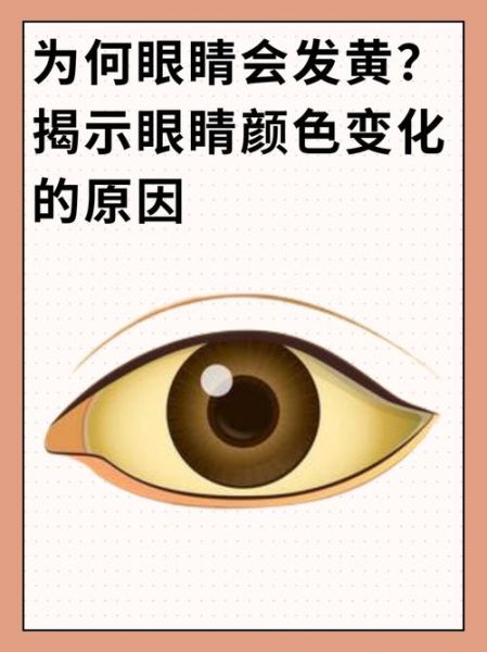 眼睛突然发亮是什么原因_眼睛发亮是病吗