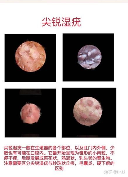 尖锐的东西有哪些_尖锐物品怎么形容