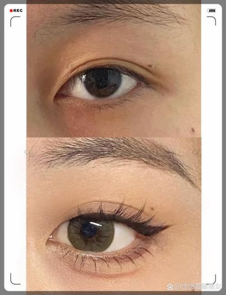 眼睛颜色会变吗_头发掉得厉害怎么办