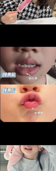 嘴巴破皮吃什么好_嘴巴破皮怎么快速好