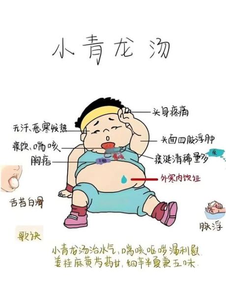 小青龙汤怎么熬_小青龙汤适合什么人喝