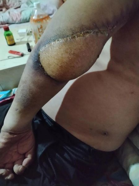 满身创伤的同义词有哪些_如何形容遍体鳞伤