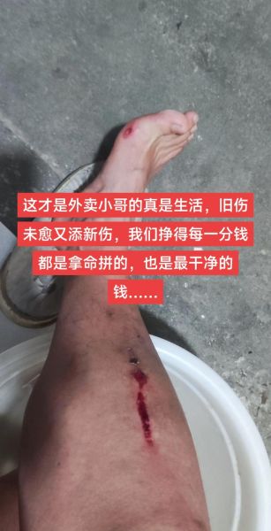 满身创伤的同义词有哪些_如何形容遍体鳞伤