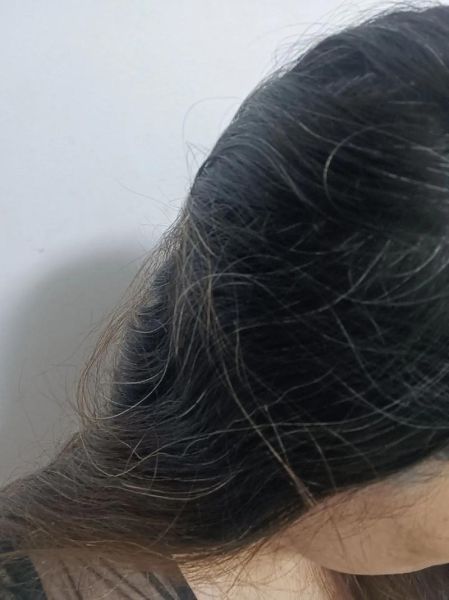 头发熬白了怎么办_头发熬白还能恢复吗