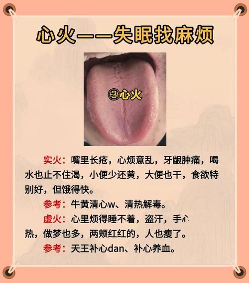 aadc火是什么_aadc火症状有哪些