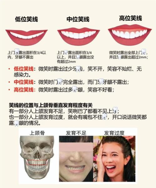 微笑和讪笑的区别是什么_如何区分微笑与讪笑