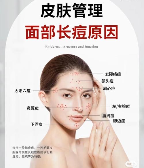 脸上长痘痘是什么原因_怎么快速消除