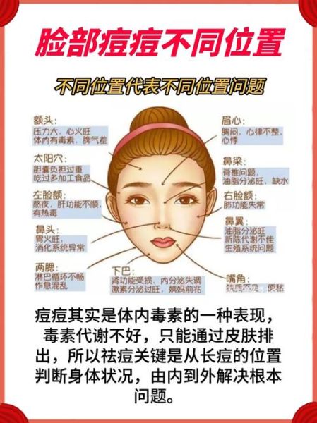 脸上长痘痘是什么原因_怎么快速消除