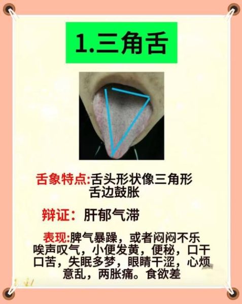 舌头嘴巴是什么词语_如何区分近义表达