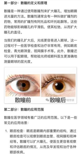 瞳孔是什么_瞳孔放大意味着什么