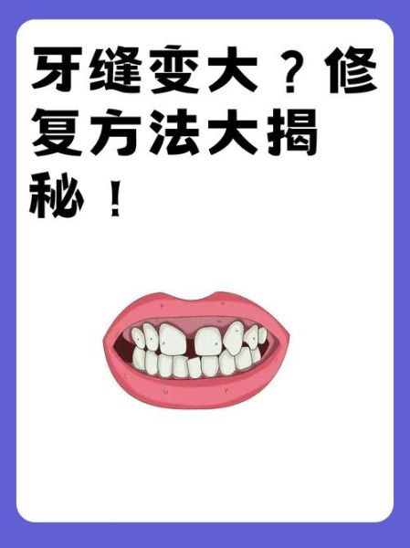 牙齿疼怎么办_牙缝大怎么补