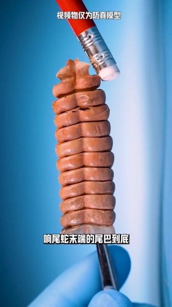 沙沙响是什么声音_沙沙响怎么消除