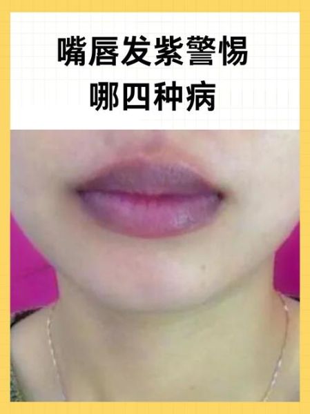 嘴巴颜色发白是什么原因_嘴唇发紫怎么调理