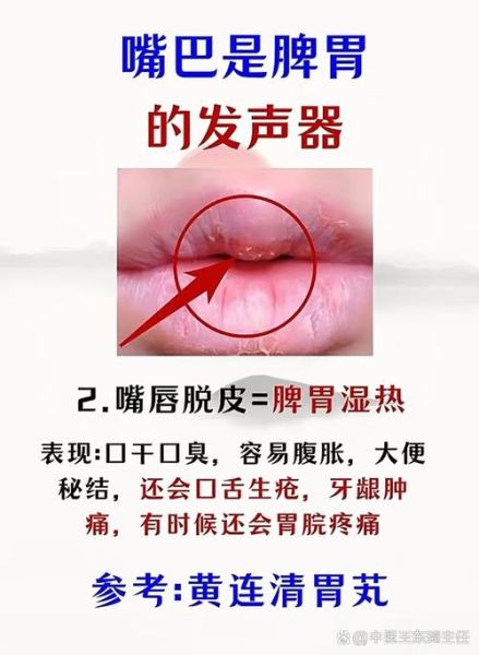 嘴巴颜色发白是什么原因_嘴唇发紫怎么调理