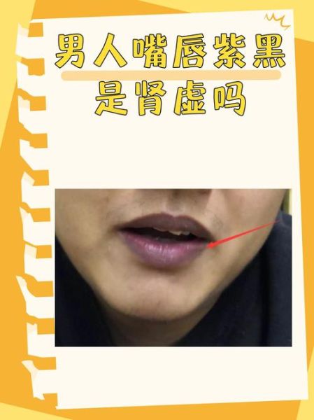 嘴巴颜色发白是什么原因_嘴唇发紫怎么调理