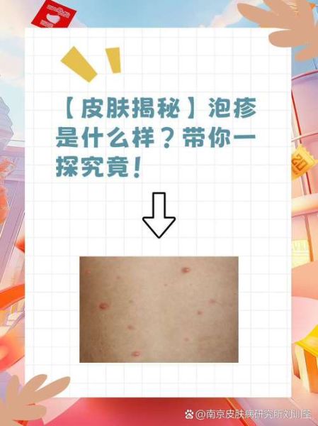 小泡泡是什么_小泡泡怎么消除