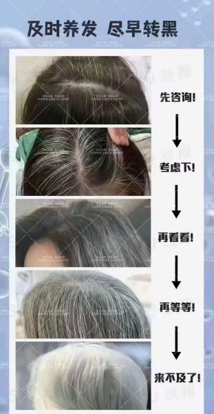 黑发变白发的真正原因_如何科学逆转