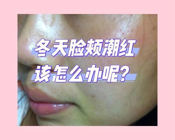 面色潮红是什么原因_面色潮红怎么调理