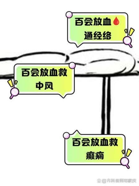 古代急救方法有哪些_古人如何止血