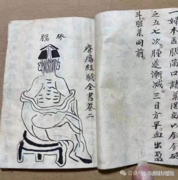 古代急救方法有哪些_古人如何止血