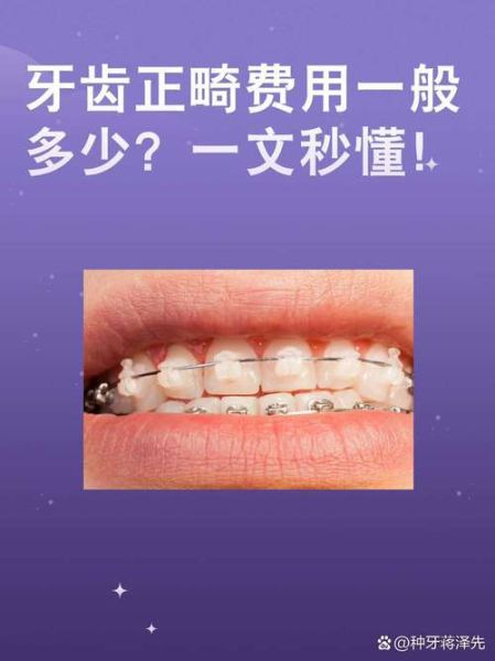 牙齿不整齐怎么办_牙齿矫正多少钱
