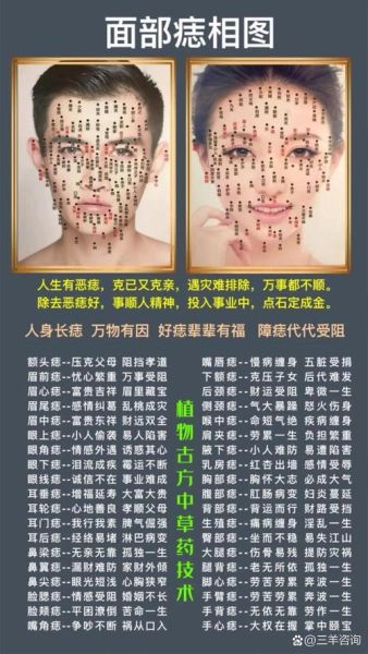 脸上的痣代表什么_面相学可信吗