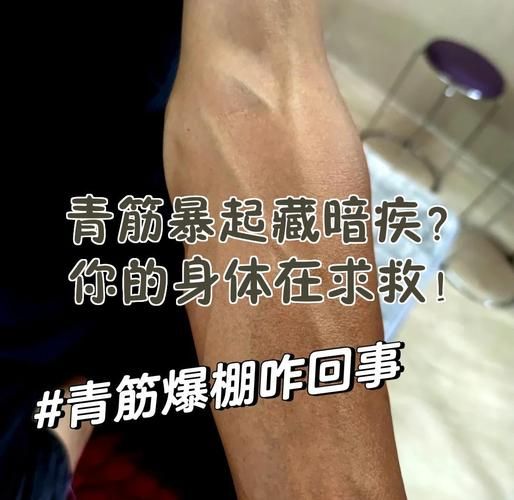 青筋爆出是什么原因_青筋爆出怎么缓解