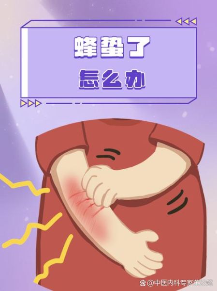 蜜蜂嗡嗡响是什么原因_晚上嗡嗡响怎么解决