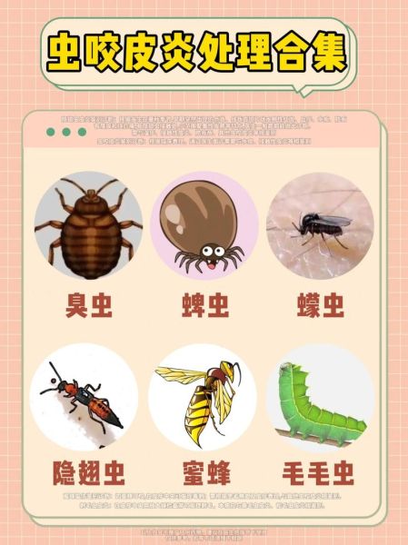 什么虫子咬了会起水泡_怎么快速止痒消肿